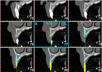 Radiología Digital 3D