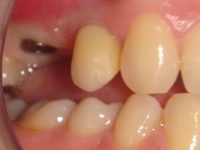 Imagen tati poner ahora 1